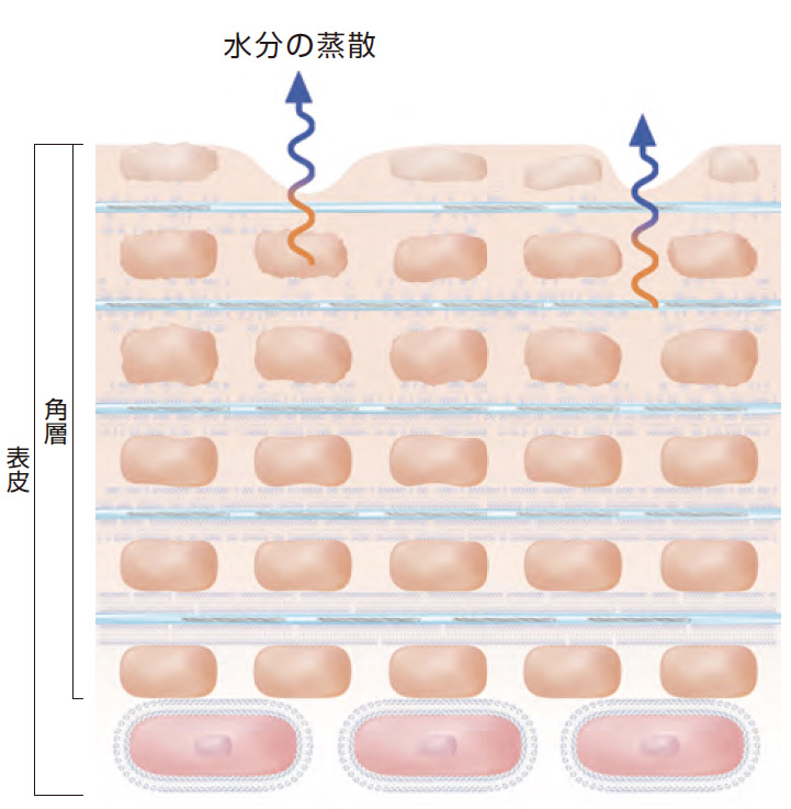 ややダメージ肌の断面図